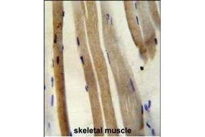 CS Antibody (N-term) (ABIN652074 and ABIN2840538) immunohistochemistry analysis in formalin fixed and paraffin embedded human skeletal muscle followed by peroxidase conjugation of the secondary antibody and DAB staining. (CS (AA 27-55), (N-Term) 抗体)