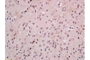 Formalin-fixed and paraffin embedded rat brain labeled with Anti-FOXB1 Polyclonal Antibody, Unconjugated  at 1:200 followed by conjugation to the secondary antibody and DAB staining. (FOXB1 抗体  (AA 1-100))