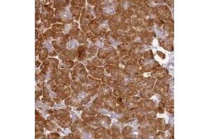 Immunohistochemical staining of human pancreas with RPL13A polyclonal antibody  shows strong cytoplasmic positivity in exocrine glandular cells at 1:50-1:200 dilution.