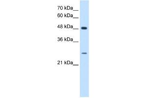 WB Suggested Anti-SH3BGR Antibody Titration:  0.
