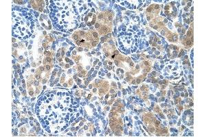 CBS antibody was used for immunohistochemistry at a concentration of 4-8 ug/ml to stain Epithelial cells of renal tubule (arrows) in Human Kidney. (CBS 抗体  (N-Term))