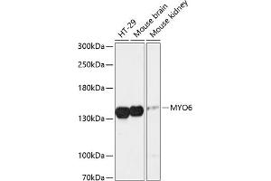 Western blot analysis of extracts of various cell lines, using MYO6 antibody (ABIN6129617, ABIN6144291, ABIN6144292 and ABIN6216869) at 1:3000 dilution. (Myosin VI 抗体  (AA 1016-1285))