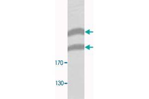Western blot analysis of HeLa membrane fraction lysate with PLXNB1 polyclonal antibody  at 1 : 300 dilution. (PLXNB1 抗体  (N-Term))