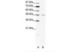Image no. 1 for anti-Cholinergic Receptor, Nicotinic, delta (Muscle) (CHRND) (N-Term) antibody (ABIN202701) (CHRND 抗体  (N-Term))