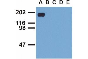 Western blotting analysis of EGFR (phospho-Tyr992) by mouse monoclonal antibody EM-12 inEGF-treated A431 (A), CALU-3 (B), MCF-7 (C), Jurkat (D) and Ramos (E) cell lines (reduced conditions). (EGFR 抗体  (Tyr992))