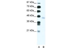 Human Jurkat; WB Suggested Anti-ZNF312 Antibody Titration: 2. (FEZF2 抗体  (N-Term))