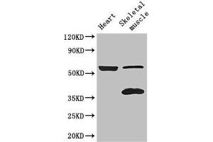 Western Blot Positive WB detected in: Mouse heart tissue, Mouse skeletal muscle tissue All lanes: IQCG antibody at 3. (IQCG 抗体  (AA 1-134))