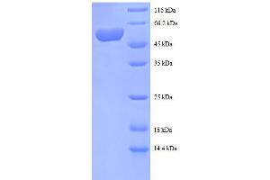 SDS-PAGE (SDS) image for Spermidine Synthase (SRM) (AA 17-302), (partial) protein (GST tag) (ABIN7479595) (Spermidine Synthase Protein (SRM) (AA 17-302, partial) (GST tag))
