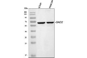 Western blot analysis of GAD65 using anti-GAD65 antibody (ABIN5518755).