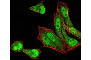 Immunofluorescence analysis of Hela cells using MGMT mouse mAb (green). (MGMT 抗体  (AA 32-210))