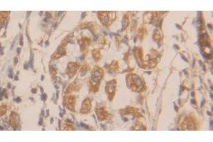 Immunohistochemistry (IHC) image for anti-Charcot-Leyden Crystal Protein (CLC) (AA 2-142) antibody (ABIN7434860)