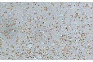 Immunohistochemistry of paraffin-embedded Rat brain tissue using Phospho-CAMK2 beta/gamma/delta (Thr287) Monoclonal Antibody at dilution of 1:200. (CaMK2 beta/gamma/delta (pThr287) 抗体)