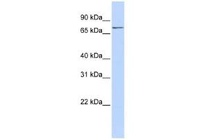 WB Suggested Anti-NCAPH2 Antibody Titration: 0. (NCAPH2 抗体  (N-Term))