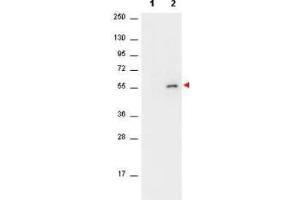 Western Blotting (WB) image for anti-V-Akt Murine Thymoma Viral Oncogene Homolog 1 (AKT1) (pSer473) antibody (ABIN964561)