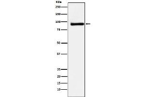 Western blot analysis of KAISO expression in MCF7 cell lysate.