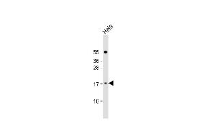 Anti-LSM7 Antibody (C-term) at 1:1000 dilution + Hela whole cell lysate Lysates/proteins at 20 μg per lane. (LSM7 抗体  (C-Term))
