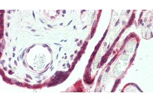Immunohistochemistry of paraffin-embedded Human Placenta using PAPPA Polyclonal Antibody at dilution of 1:100. (PAPPA 抗体)