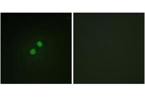Immunofluorescence analysis of NIH-3T3 cells, using Nibrin (Phospho-Ser278) Antibody. (Nibrin 抗体  (pSer278))