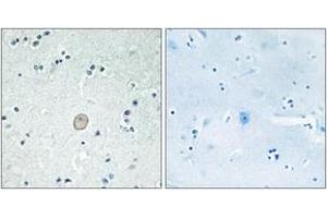 Immunohistochemistry analysis of paraffin-embedded human brain tissue, using C3AR1 Antibody. (C3AR1 抗体  (AA 175-224))