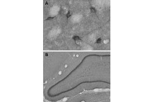 A: Indirect immunohystochemistry of a mouse striatum section (dilution 1 : 100). (ChT 抗体  (AA 501-580))