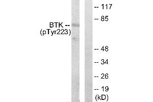 Western blot analysis of extracts from Hela cells treated with serum (10%, 15mins), using BTK (phospho-Tyr223) antibody. (BTK 抗体  (pTyr223))