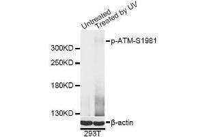 Western blot analysis of extracts of 293T cells, using Phospho-ATM-S1981 antibody (ABIN5969871) at 1/2000 dilution. (ATM 抗体  (pSer1981))