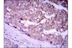 Image no. 3 for anti-Glypican 3 (GPC3) (AA 55-200) antibody (ABIN1498500)