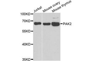 Western blot analysis of extracts of various cell lines, using PAK2 antibody. (PAK2 抗体  (AA 1-212))