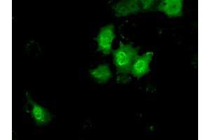 Anti-KHK mouse monoclonal antibody (ABIN2453197) immunofluorescent staining of COS7 cells transiently transfected by pCMV6-ENTRY KHK (RC202424). (Ketohexokinase 抗体)
