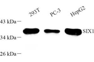 Western blot analysis of SIX1 (ABIN7075617) at dilution of 1: 500 (SIX Homeobox 1 抗体)