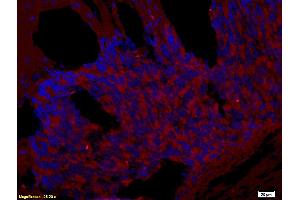 Formalin-fixed and paraffin embedded rat brain tissue labeled with Rabbit Anti-CD272/BTLA Polyclonal Antibody (ABIN671031), Unconjugated at 1:200 followed by conjugation to the secondary antibody and DAB staining. (BTLA 抗体  (AA 221-289))