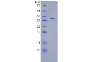 SDS-PAGE analysis of Mouse DGKa Protein.
