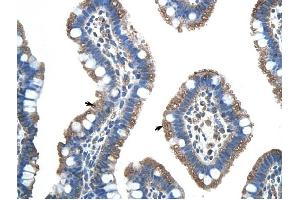 FUS antibody was used for immunohistochemistry at a concentration of 4-8 ug/ml to stain Epithelial cells of intestinal villus (arrows) in Human Intestine. (FUS 抗体  (N-Term))