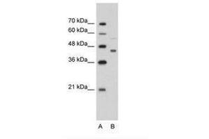 Image no. 2 for anti-Creatine Kinase, Mitochondrial 2 (Sarcomeric) (CKMT2) (AA 22-71) antibody (ABIN203381)