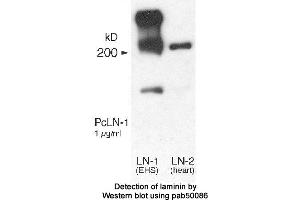 Image no. 1 for anti-Laminin (LN) antibody (ABIN363395) (Laminin 抗体)