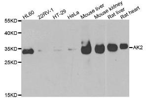 Western blot analysis of extracts of various cell lines, using AK2 antibody. (Adenylate Kinase 2 抗体)