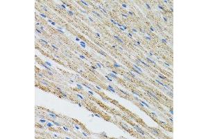 Immunohistochemistry of paraffin-embedded mouse heart using MYOT antibody. (Myotilin 抗体  (AA 259-314))