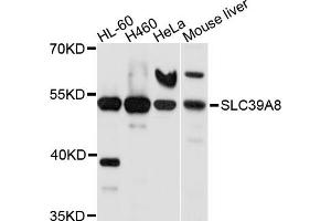 Western blot analysis of extracts of various cell lines, using SLC39A8 antibody (ABIN5998862) at 1/1000 dilution. (SLC39A8 抗体)
