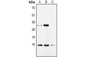 Western blot analysis of CDA expression in HepG2 (A), Hela (B), mouse kidney (C) whole cell lysates. (CDA 抗体)