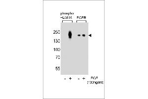 Western blot analysis of lysate from A431 cells(from left to right),untreated or treated with EGF at 100 ng/mL,using Phospho-EGFR-p Antibody (ABIN389891 and ABIN2839735) or EGFR-p Antibody. (EGFR 抗体  (pTyr1016))