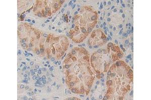 Used in DAB staining on fromalin fixed paraffin- embedded kidney tissue (MCCC2 抗体  (AA 337-563))