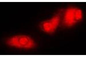 Immunofluorescent analysis of S6K1 staining in MCF7 cells. (RPS6KB1 抗体  (C-Term))
