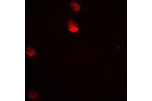 Immunofluorescent analysis of JNK1 staining in Hela cells. (JNK 抗体)