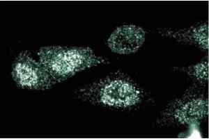 Immunofluorescent staining of HeLa cells. (CD40 抗体  (AA 71-187))