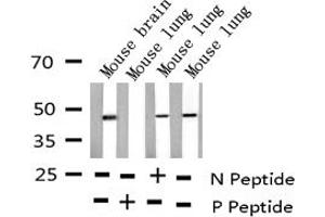 Western blot analysis of Phospho-E2F1 (Thr433) expression in various lysates (E2F1 抗体  (pThr433))