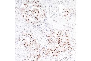 Immunohistochemistry (IHC) image for anti-TNF Receptor-Associated Factor 4 (TRAF4) (AA 420-470) antibody (ABIN7454472)