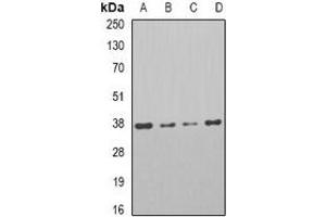 Western blot analysis of PAR6A expression in HT29 (A), Jrukat (B), Raji (C), mouse testis (D) whole cell lysates. (PARD6A 抗体)