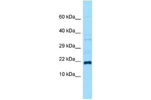 Host:  Rabbit  Target Name:  Grem1  Sample Type:  Mouse Testis lysates  Antibody Dilution:  1. (GREM1 抗体  (C-Term))