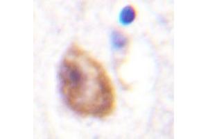 Immunohistochemistry analyzes of DDX3 antibody in paraffin-embedded human brain tissue. (DDX3X 抗体)