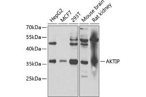Western blot analysis of extracts of various cell lines, using AKTIP antibody (ABIN6131091, ABIN6136746, ABIN6136748 and ABIN6221837) at 1:1000 dilution. (AKTIP 抗体  (AA 1-292))